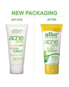 Alba Botanica Acnedote Maximum Strength Oil Control Lotion 2 Oz