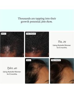 Nutrafol Women Hair Growth Nutraceutical Supplement 120 Caps